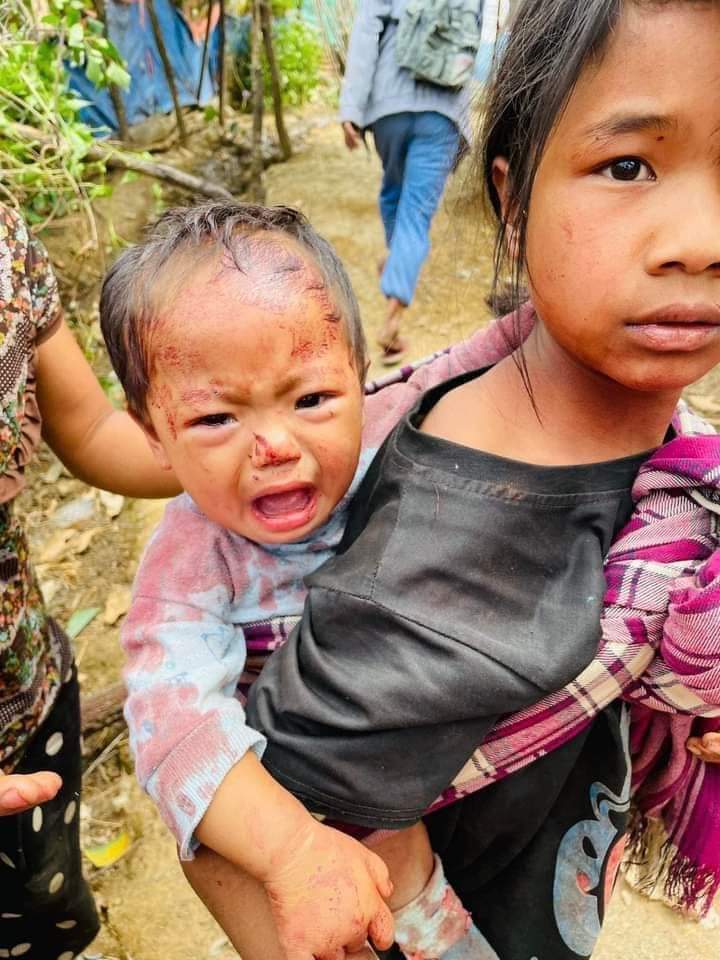 Dear Uncle Kelly, I am reaching out to you with some urgent prayer requests. From March 30th to April 3rd, a 120-strong Military Council unit arrived in Letpan village (Northern of Kalaymyo) and engaged in conflict with ethnic armed groups, setting fire to 128 houses. The actual number of houses destroyed in the village is likely even higher. All the villagers affected are believers in God's Home. They have lost their homes and all their belongings due to the actions of the military junta, which have been extremely distressing. On April 4th, intense fighting between Myanmar's military junta forces and the People's Defence Force (PDF) was still ongoing in the villages. As a result, thousands of people have fled to Kalaymyo for their safety. It is particularly troubling that all of this is happening just 15 miles away from God's Home. The arson attack, along with airstrikes carried out by jet fighters and shots fired from helicopters, has forced the entire village population to flee. Those who didn't have a place to seek refuge had to take shelter in the forests. Providing humanitarian assistance has been challenging, especially in our city where the needs are most critical. Currently, God's Home is providing food to 28 displaced individuals, including children. The situation in Myanmar is marked by escalating violence and insecurity, resulting in significant internal displacement. Our humble prayer is that God will bring an end to this terrible situation soon and restore peace in the country. Thank you for joining us in prayer for God's Home and for peace to be restored in Myanmar. May God bless you,